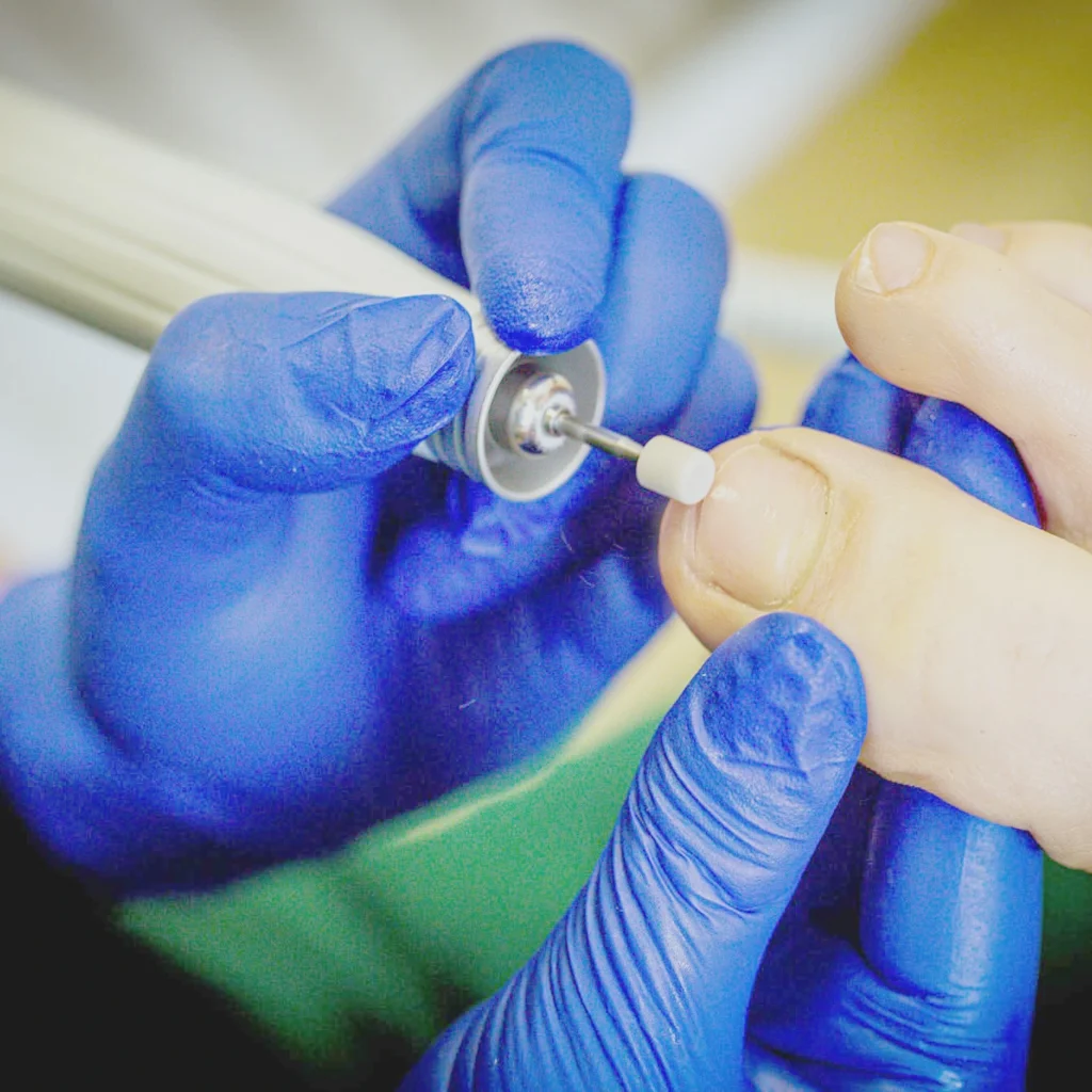 Podolog Światłoczułe Kinga